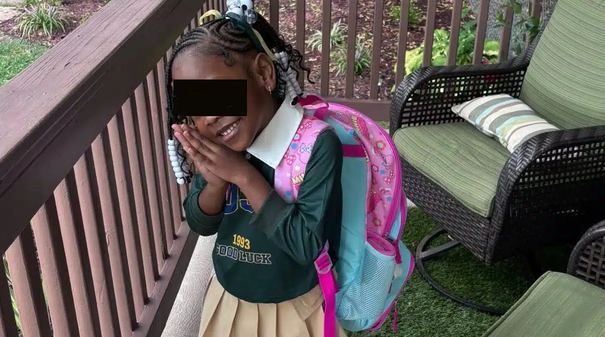 Meninos deixaram esta criança irreconhecível