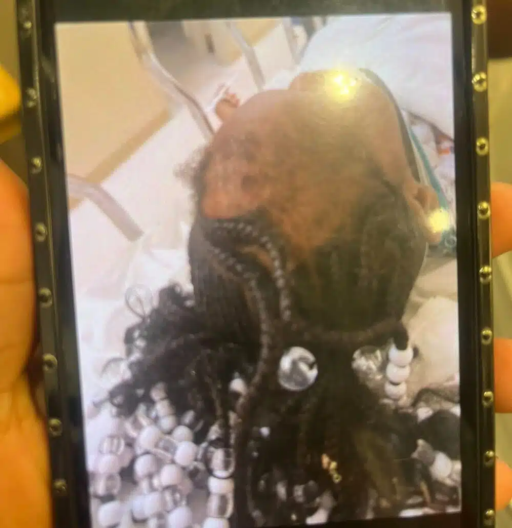 Menina ficou sem os cabelos após o que os meninos fizeram