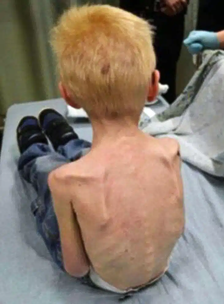 Menino Jordan Bleimeyer foi encontrado desta forma