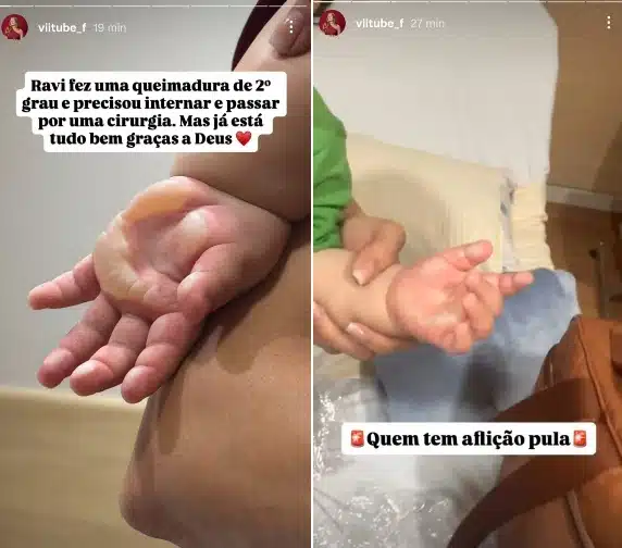 Filho caçula de Viih Tube é internado na UTI após sofrer queimadura