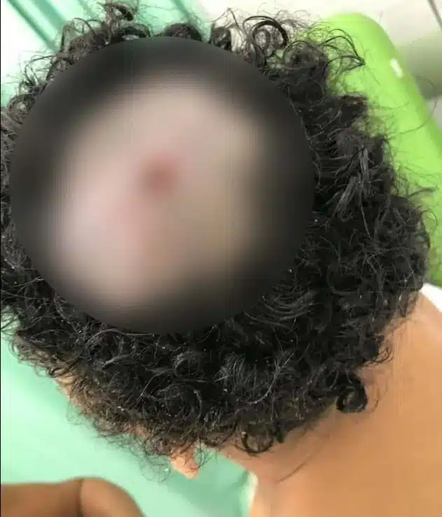 Criança que passou por situação parecida