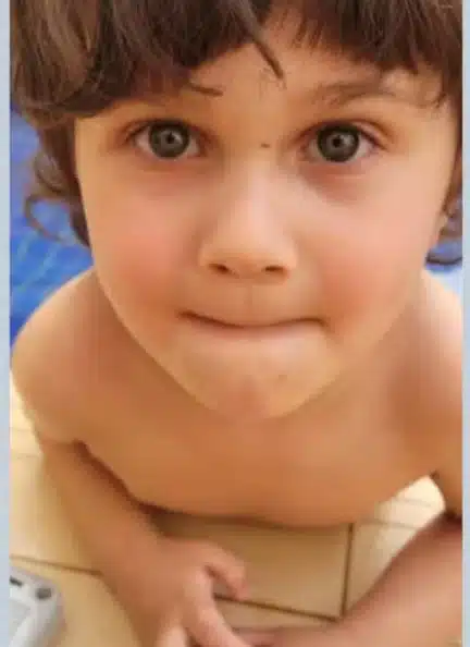 Criança está em recuperação após cair