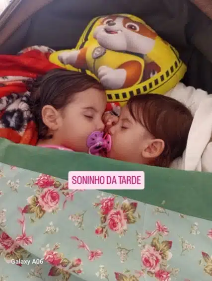 Gêmeas siamesas antes de serem separadas