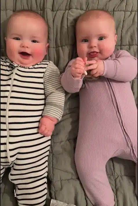 Bebês gêmeos sem os seus capacetes em fotos bem raras