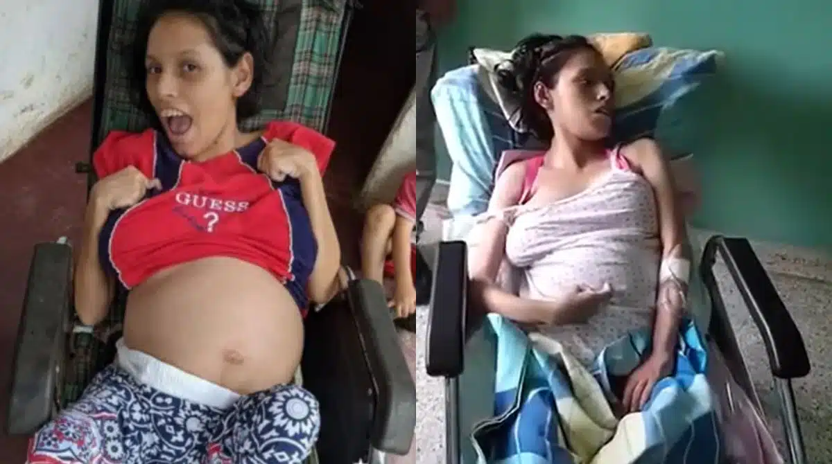 Mulher especial ficou grávida e o caso está sendo investigado