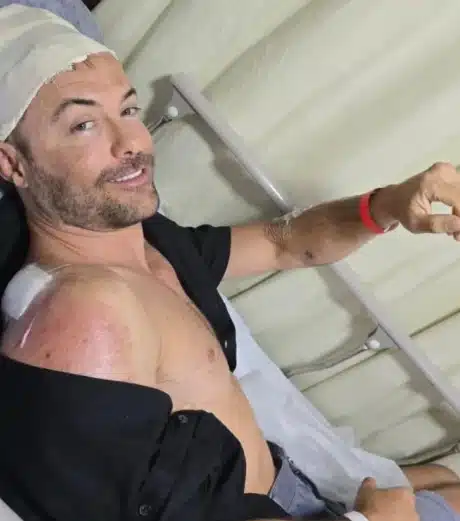 Kayky Brito revela novo acidente e impressiona