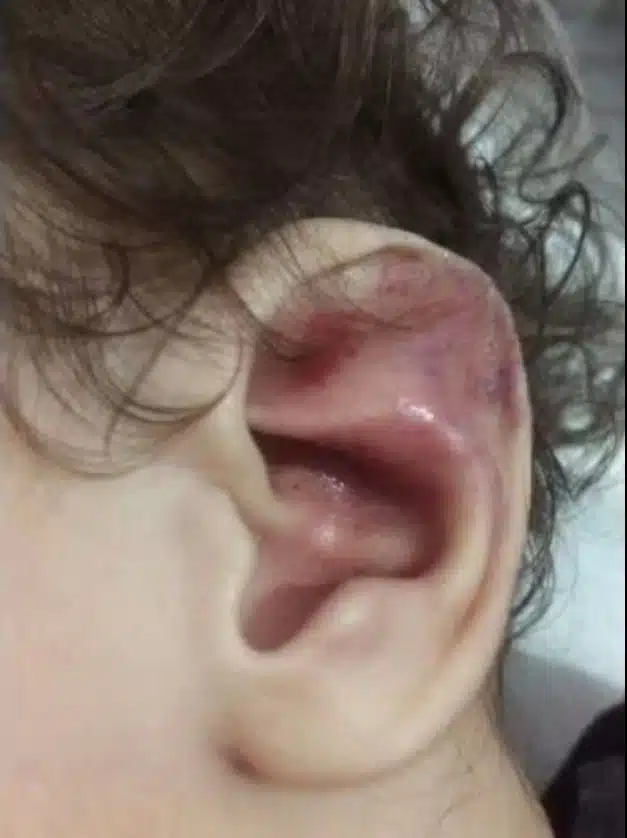 O que a mãe fez com sua bebê