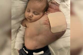 Mãe revelou como o seu bebê ficou