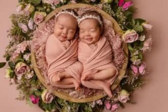 Bebês gêmeas de cantora foram diagnosticadas