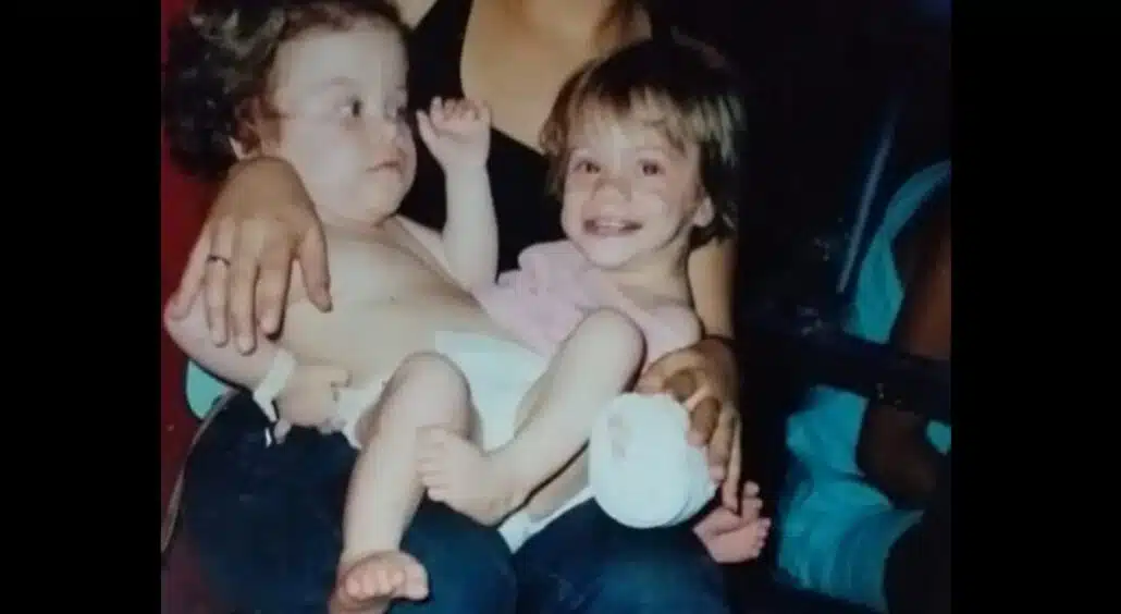 As gêmeas antes de sua separação