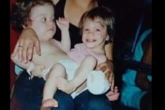 Gêmeas siamesas revelaram como estão