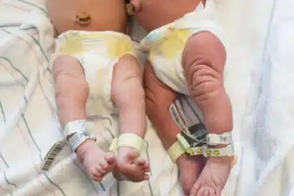 Grávida de gêmeos só recebeu um dos bebês e falou