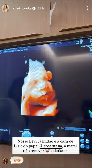 Lorena Improta encantou ao mostrar ultrassom do seu bebê com Léo Santana