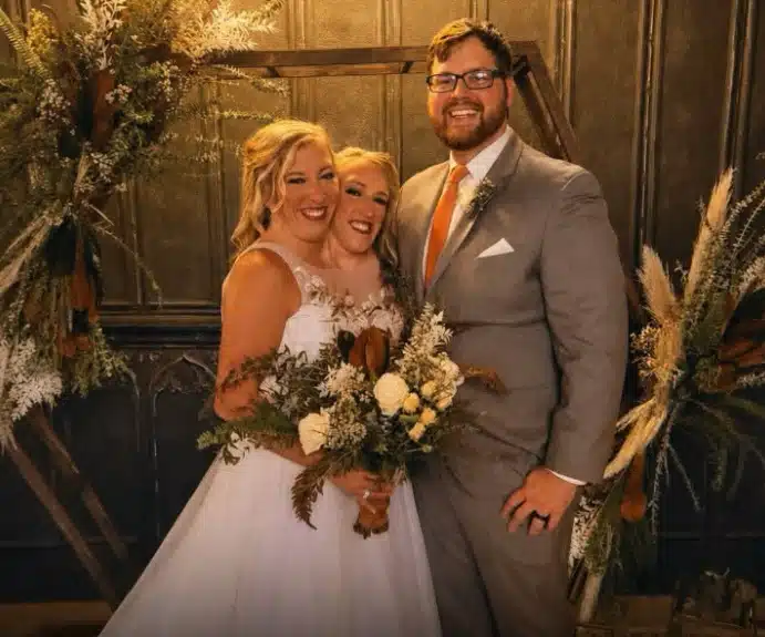 As gêmeas siamesas durante o seu casamento