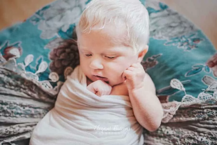 A bebê Noralynn Kay e seus cabelos brancos
