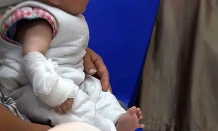 Bebê enrosca o dedo em cabelo e quase tem que amputa-lo