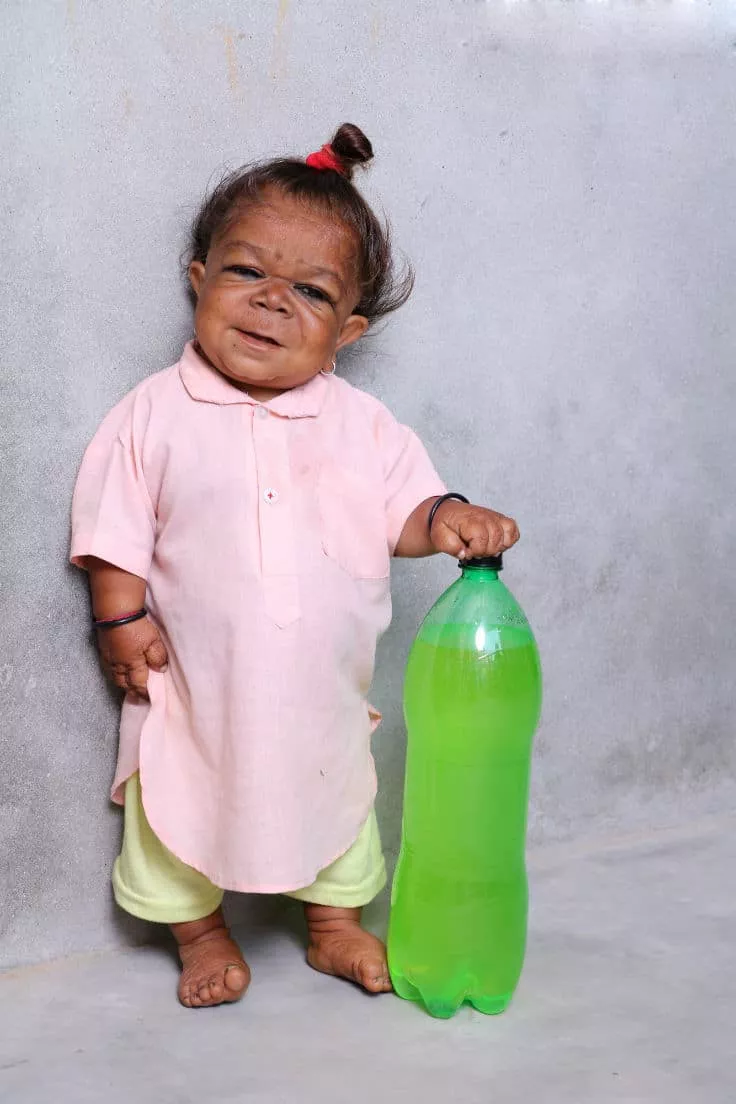 O "bebê" indiano é considerado um dos menores homens do mundo