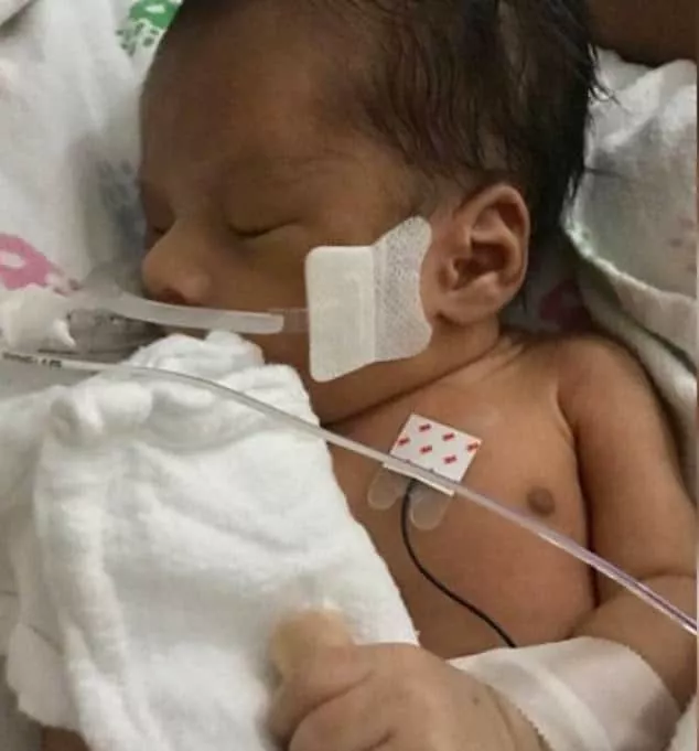 Divulgada a primeira foto do bebê que foi tirado da barriga de mãe 
