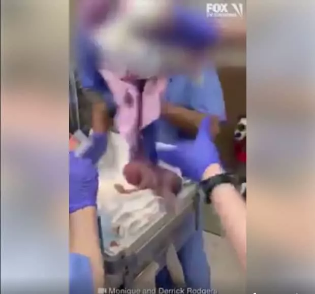 A bebê recém-nascida logo após cair