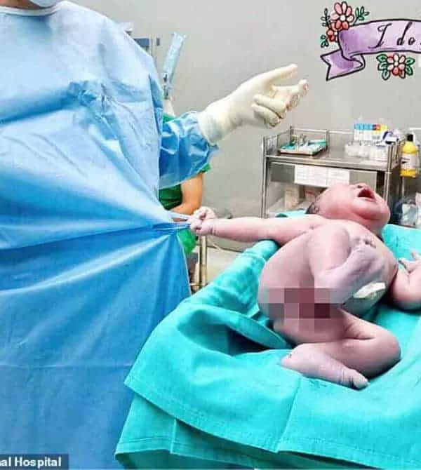O bebê recém-nascido segurou a roupa do médico com força