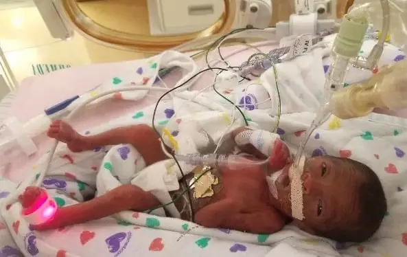 O bebê Sa´Briyah foi um dos sobreviventes do Florence