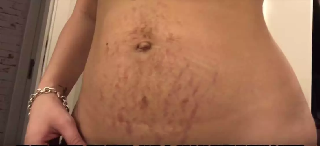 A youtuber também mostrou sua barriga após dar à luz