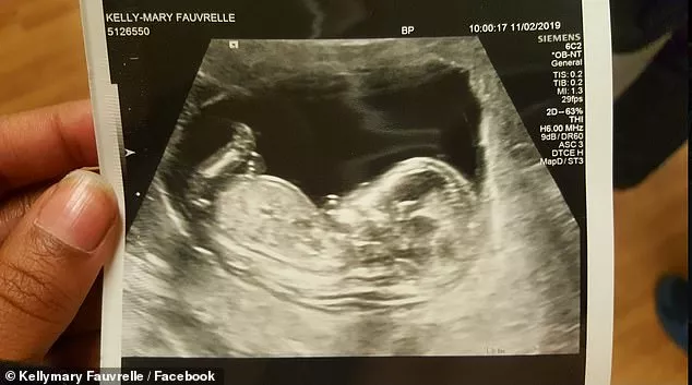 O ultrassom do bebê da grávida que foi esfaqueada