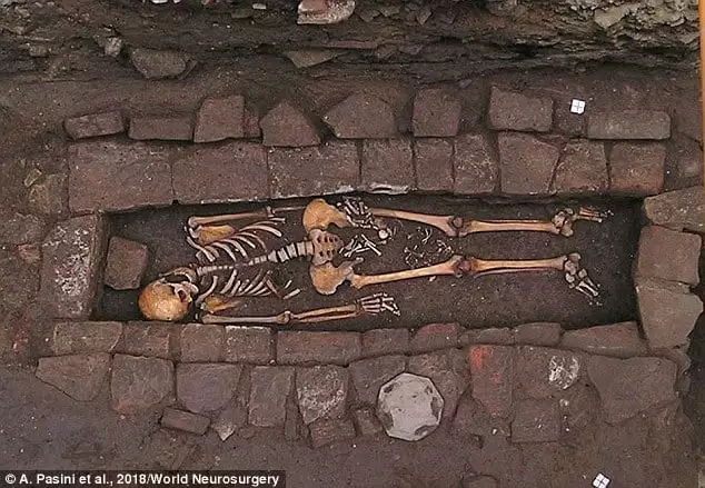 Veja agora a imagem do esqueleto encontrado com ossos de bebê