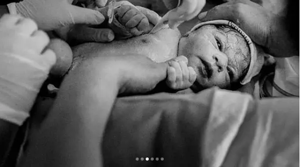 Outra imagem do parto de Yolanda filha de Juliana Alves