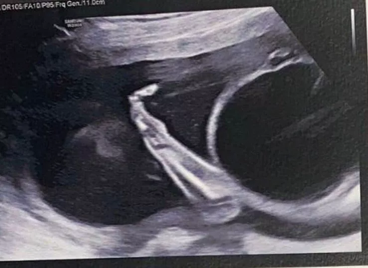 Artista plástico Kobra mostrando o ultrassom de sua bebê