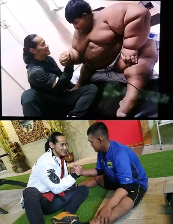 Antes e depois de menino considerado o mais gordo do mundo