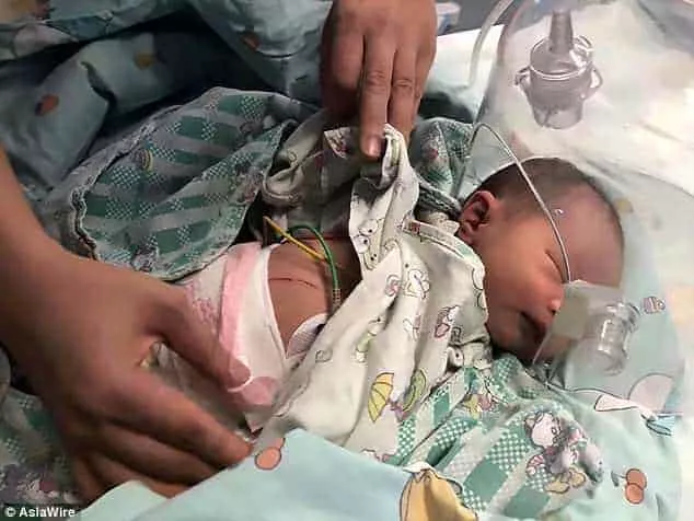 Foto da recém-nascida sendo tratada no hospital