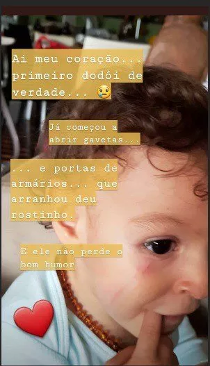 Sheron Menezzes postou essa imagem após seu filho Benjamim ter machucado o rosto