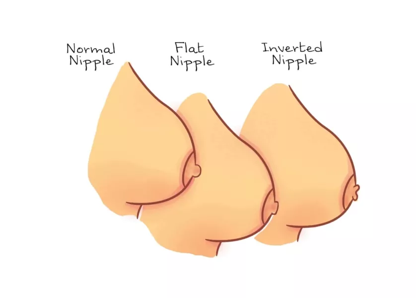 Desenho mostra como são três tipos de mamilos