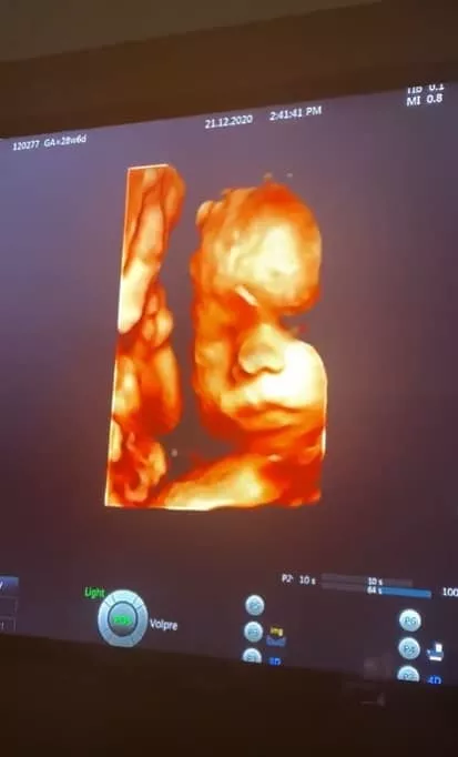 Exame de ultrassom do bebê de Lucas Lucco