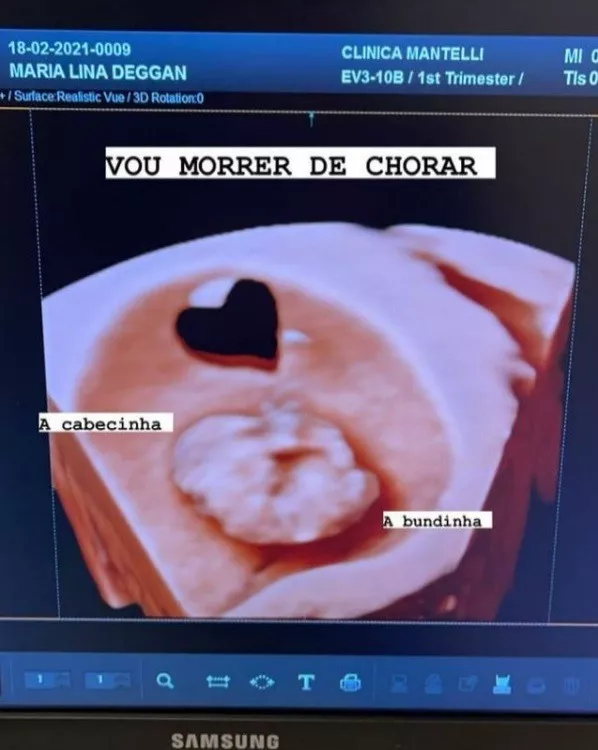 O filho de Whindersson Nunes em seu ultrassom 3D