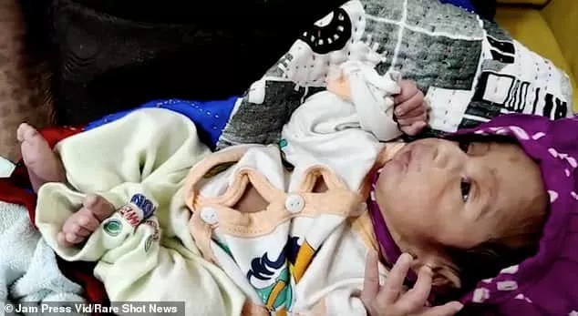 Bebê recém-nascido que nasceu de uma mulher de 70 anos