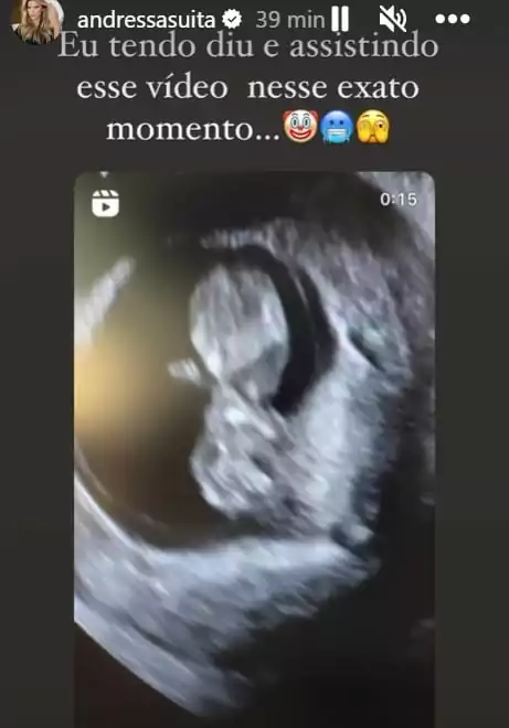 Andressa Suita surpreendeu ao mostrar este ultrassom