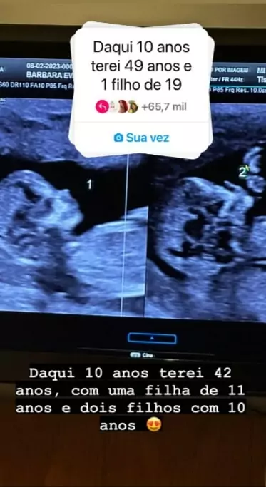 Bárbara Evans exibe ultrassom de seus bebês gêmeos e encanta 
