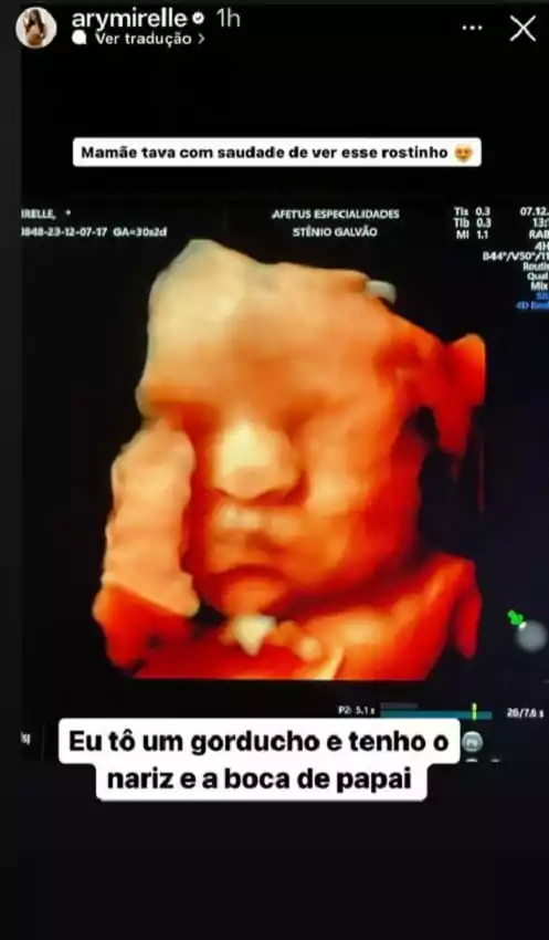 Jorge, bebê de Ary e João Gomes, em um novo ultrassom